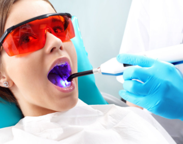 dental-fillings-mississauga-dentist
