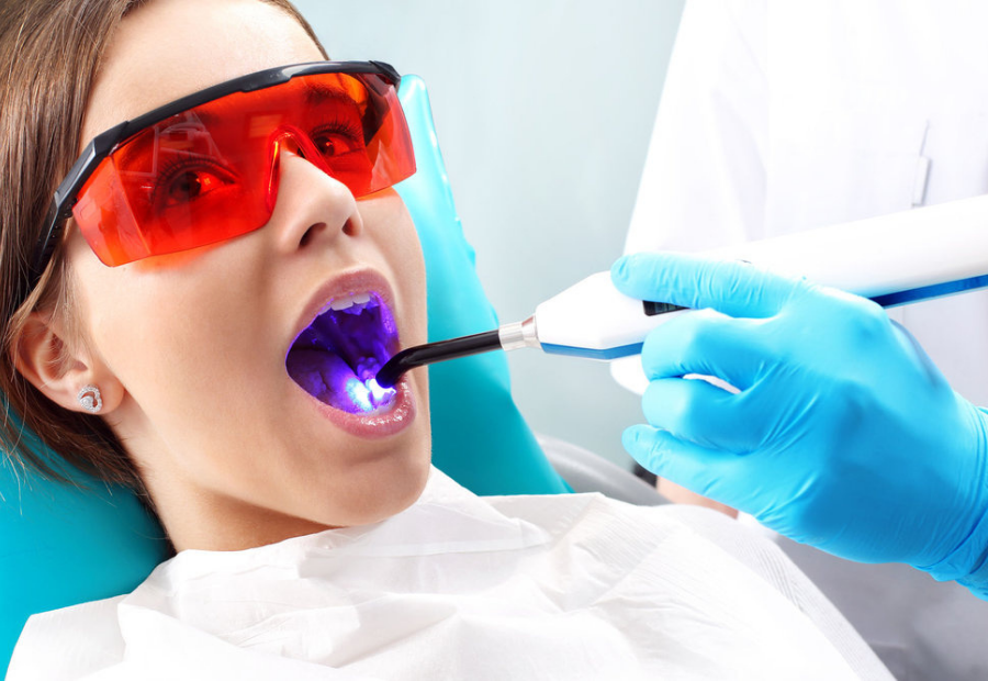 dental-fillings-mississauga-dentist