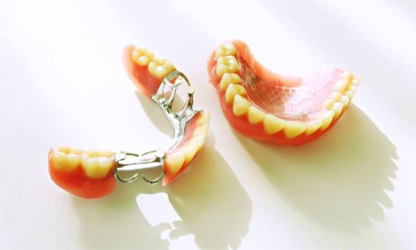 dentures-mississauga-dentist